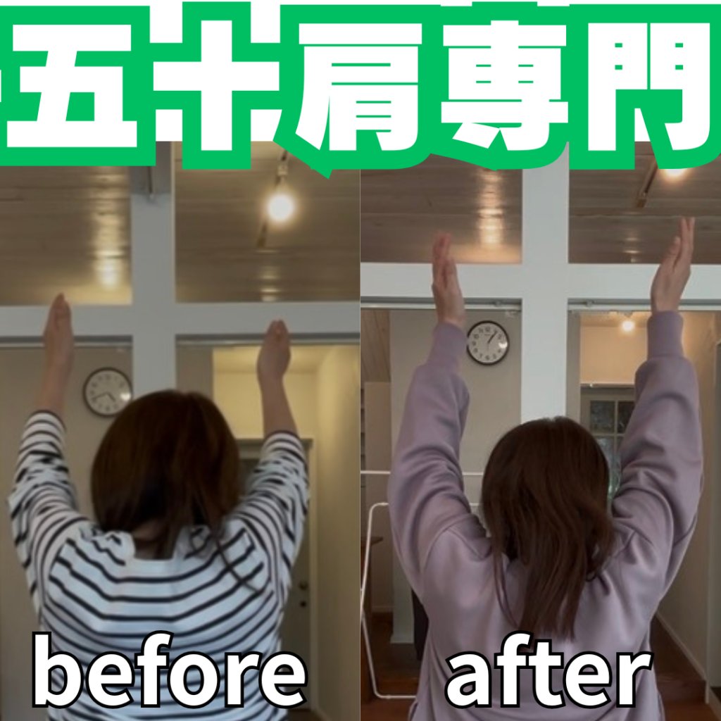 夜に肩が痛くて眠れない…それ、五十肩の典型的なサインです