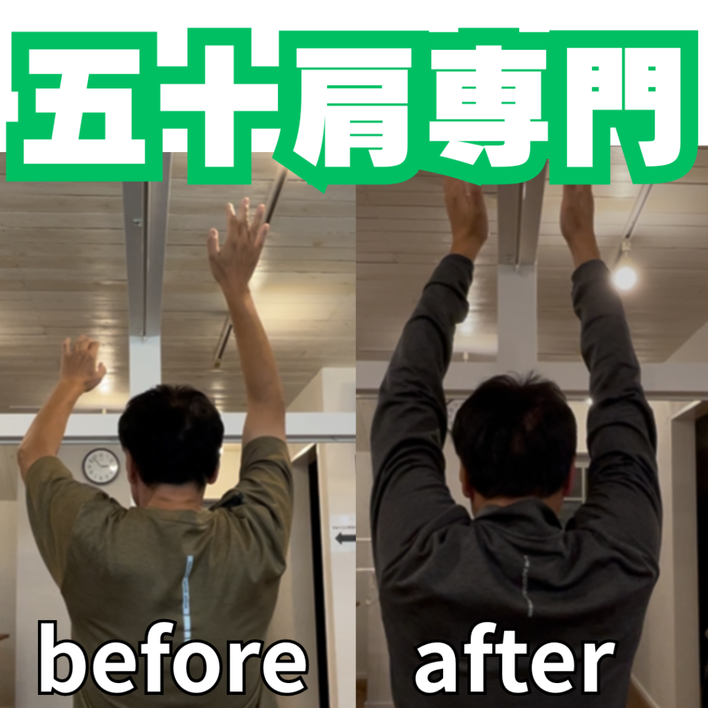 五十肩の夜間痛はいつまで続く？