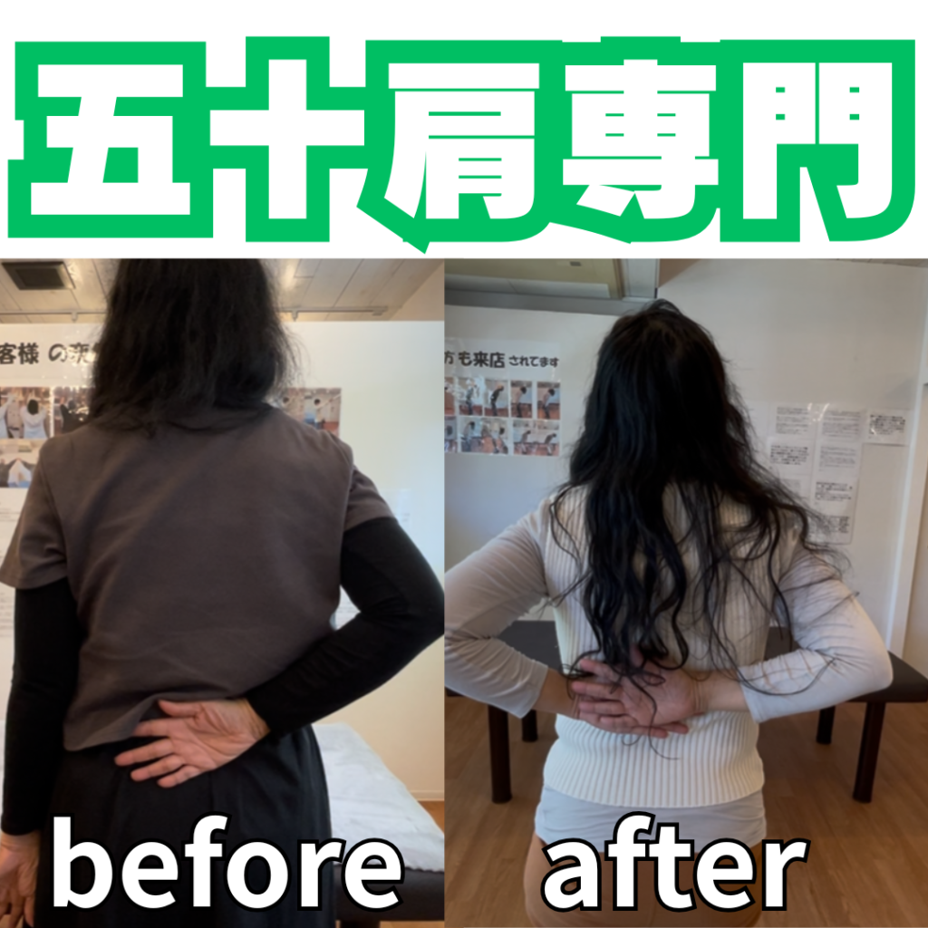 服を着るのがつらい五十肩｜放置するとどうなる？