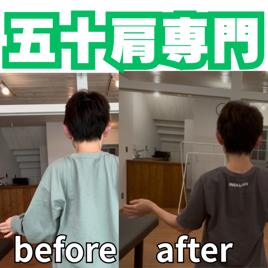 整形外科で「レントゲンは異常なし」でもなんで痛いの？どうしたら？