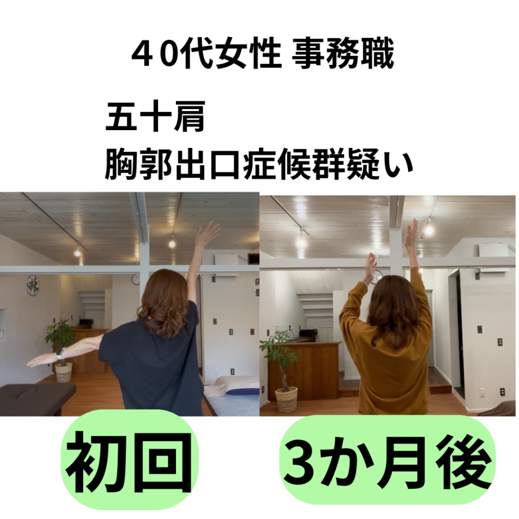 五十肩で手がしびれるのは危険？