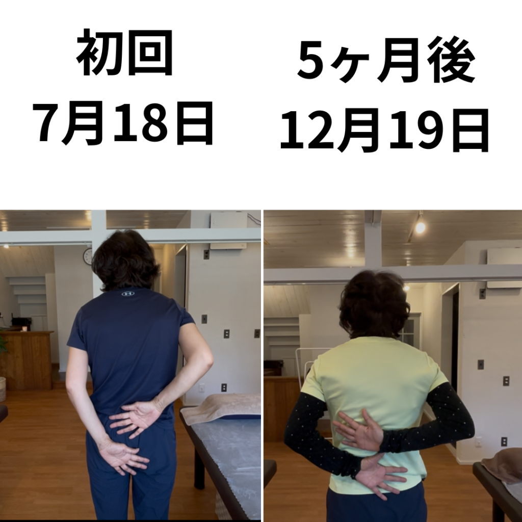 五十肩の通院頻度はどれくらい？