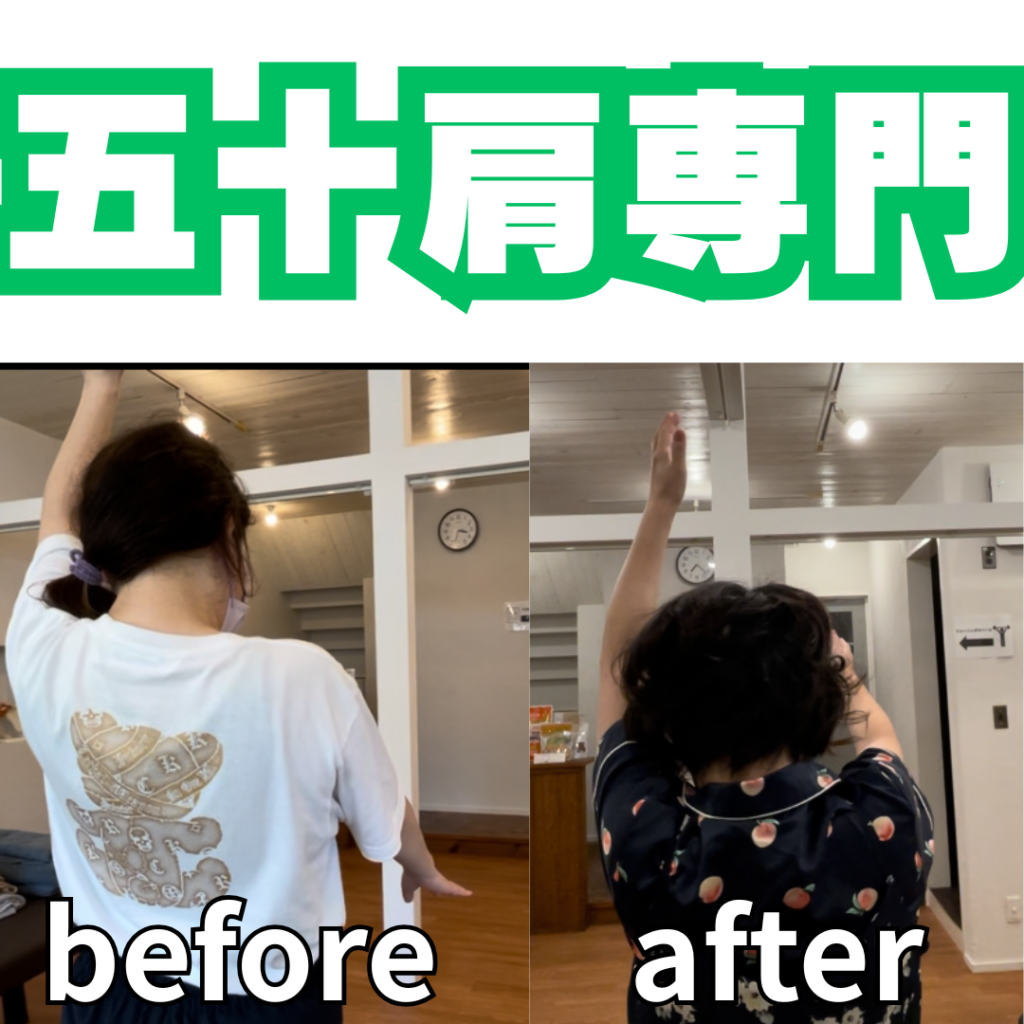 五十肩で「やってはいけないこと」