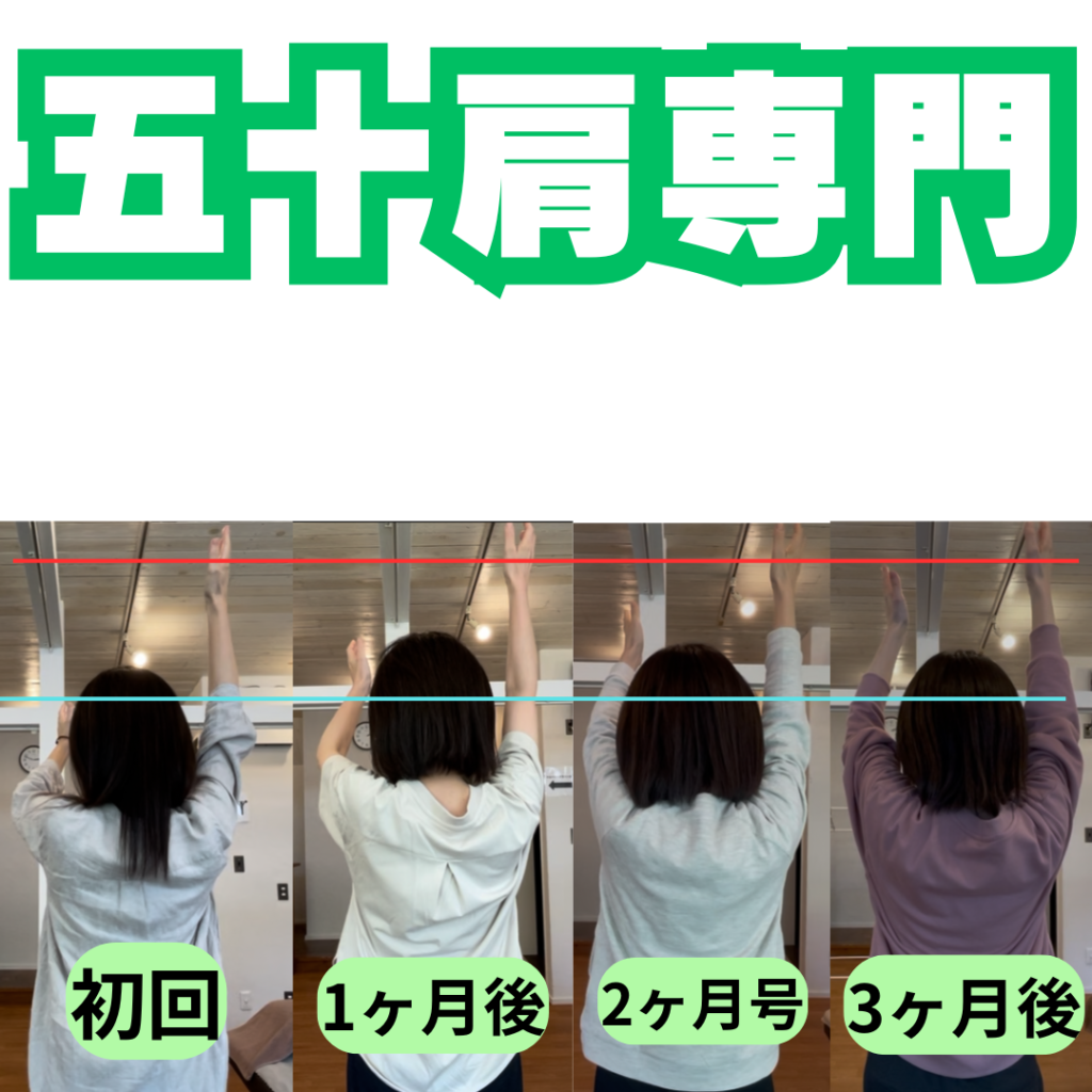 四十肩と五十肩は何が違う？